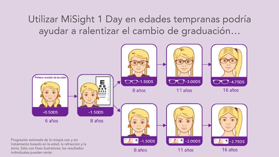 Lentes misight 2025